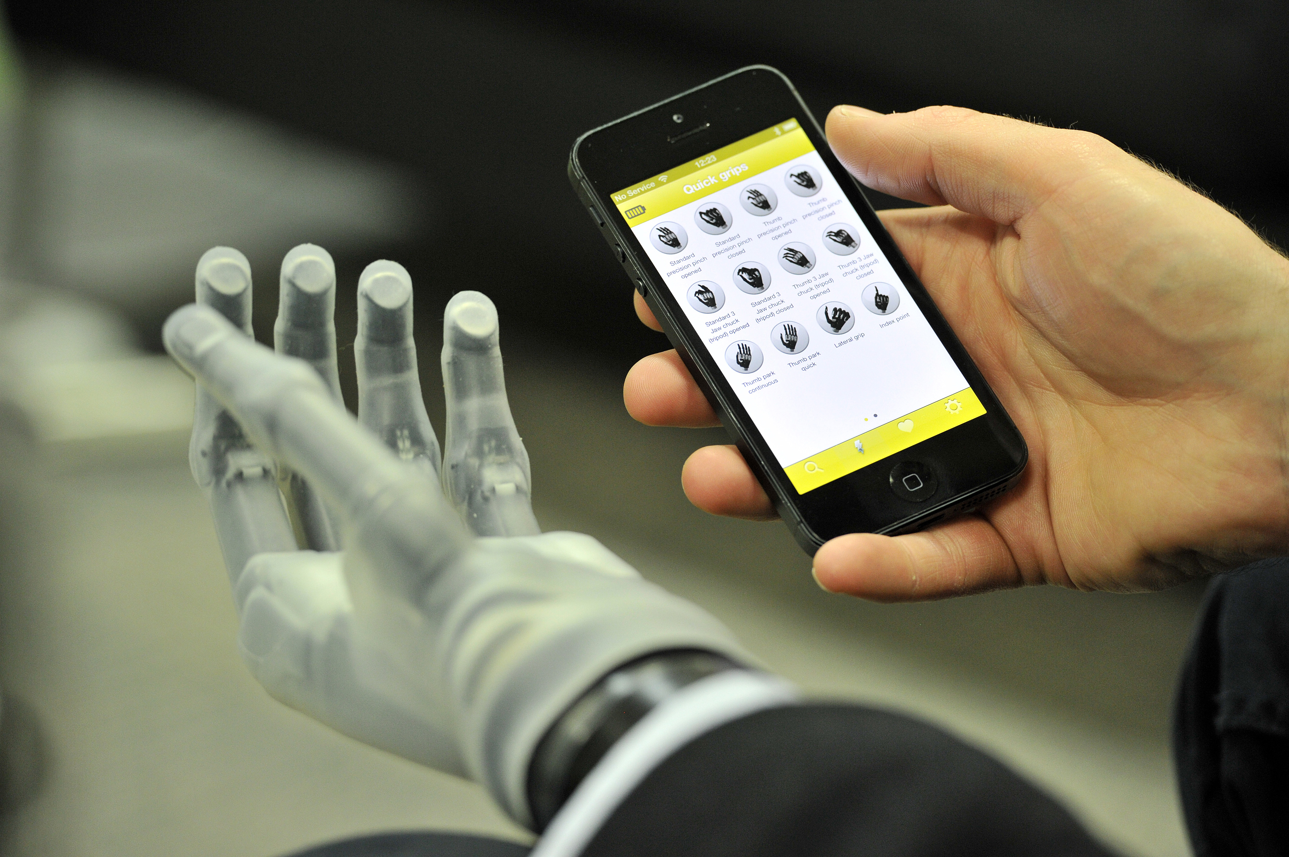 First Bionic Hand Controlled by Smartphone App