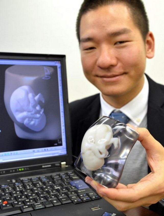 Company Develops 3D Printer Foetus Models