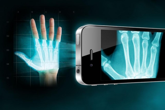 X-Ray Vision On Your Smartphone: It May Be Possible