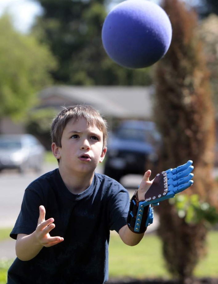 Six-Year Old Boy Receives E-Nabling 3D Printed Hand