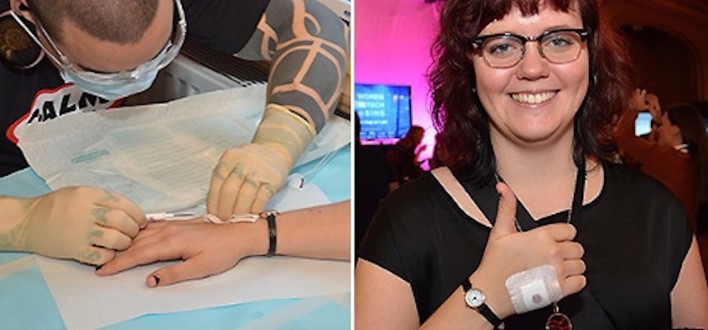 This Woman Got A Bionic Implant to Replace Her Keys