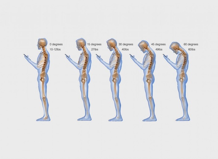 Texting Really Hurts Your Spine!