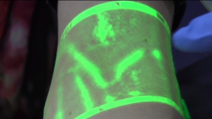 Near Infrared Light System Makes Drawing Blood Easier