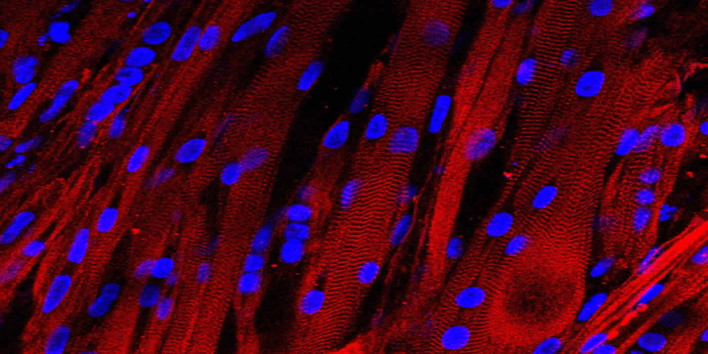 Bioengineered Human Muscle Contracts As Real Tissue