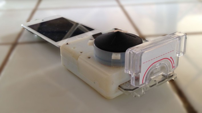 This Smartphone Dongle Tests For HIV In 15 Minutes