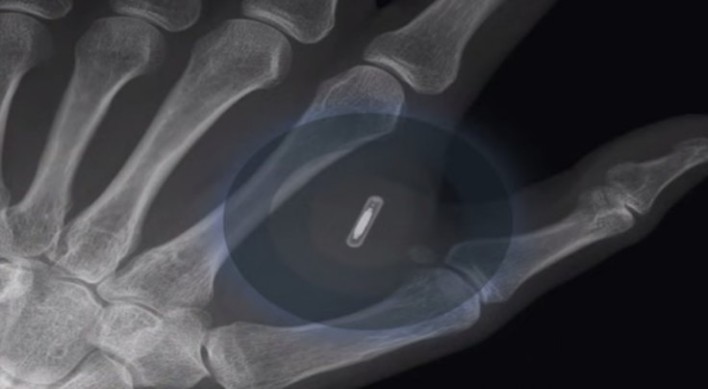 Swedish Tech Office Ditches Swipe Cards For Chip Implants