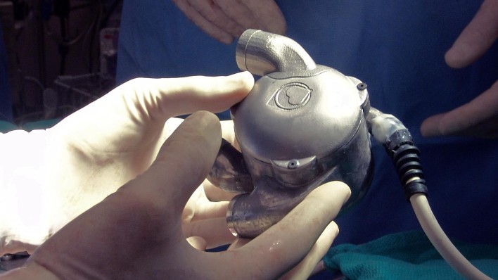BiVACOR: The Bionic Heart Set To Replace Cardiac Implants